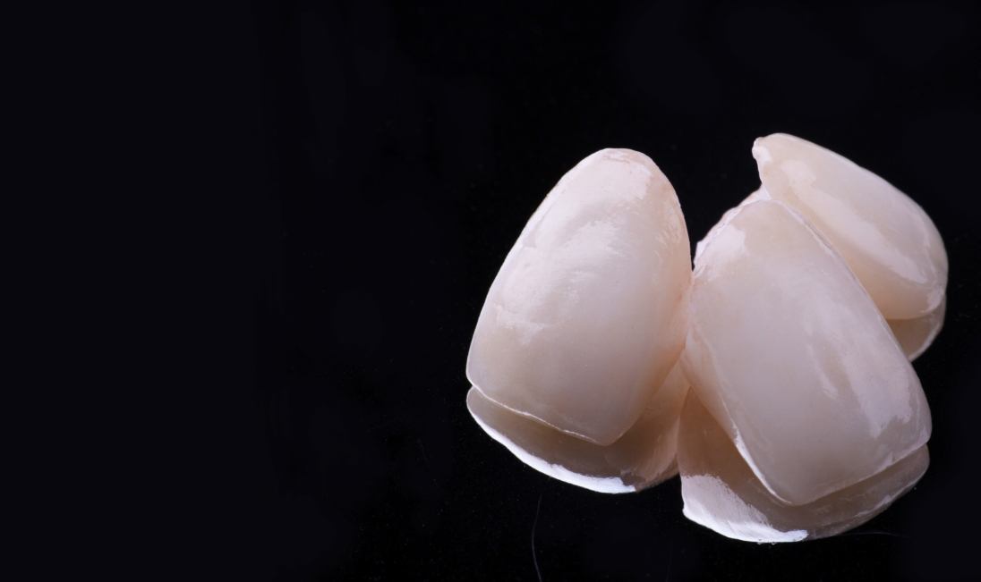 Three dental veneers in front of black background