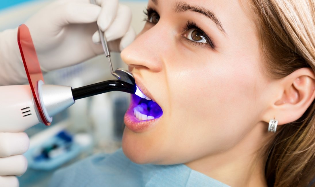 Woman receiving cosmetic dental bonding