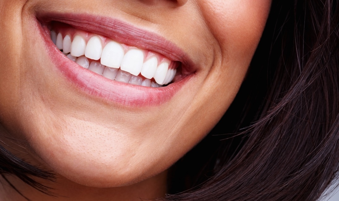 CLose up of a smiling woman with bright white teeth and healthy looking gums