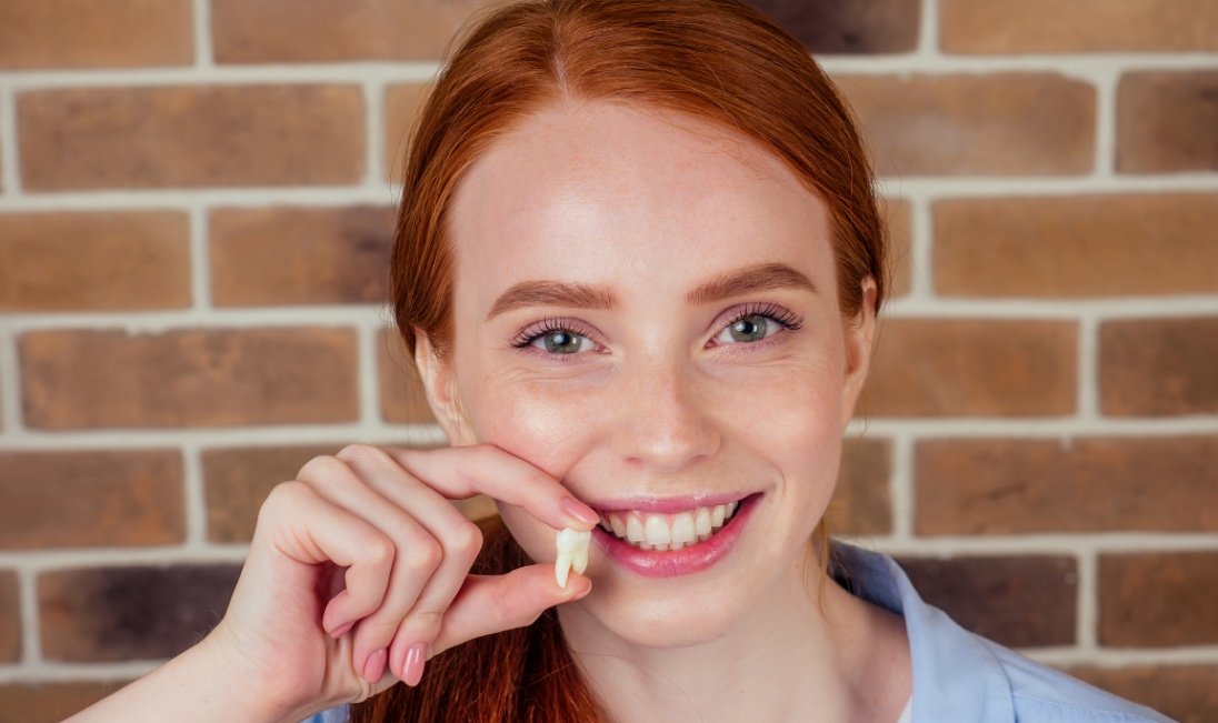 Smiling redheaded woman holding a tooth after a tooth extraction in Ramsey