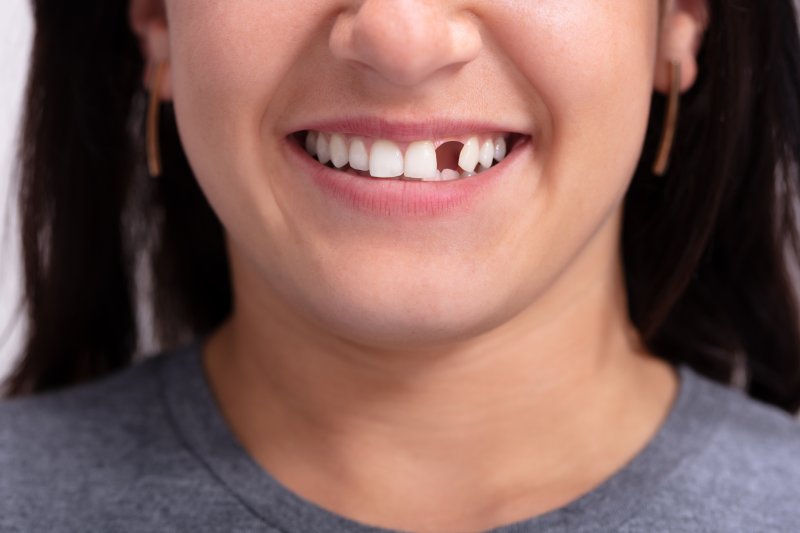 A woman smiling after her tooth extraction site healed